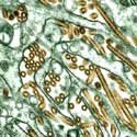H5N1 bird flu virus .. even a pandemic in the fuel use and emissions assumptions