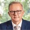 Anthony Albanese Anthony Albanese